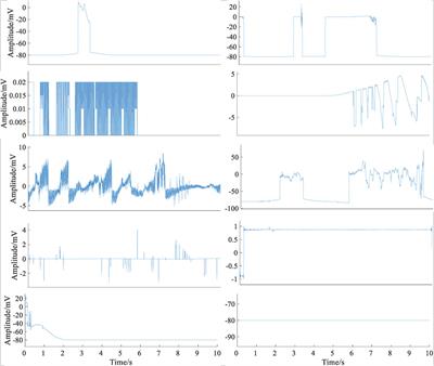 Wearable Electrocardiogram Quality Assessment Using Wavelet Scattering and LSTM